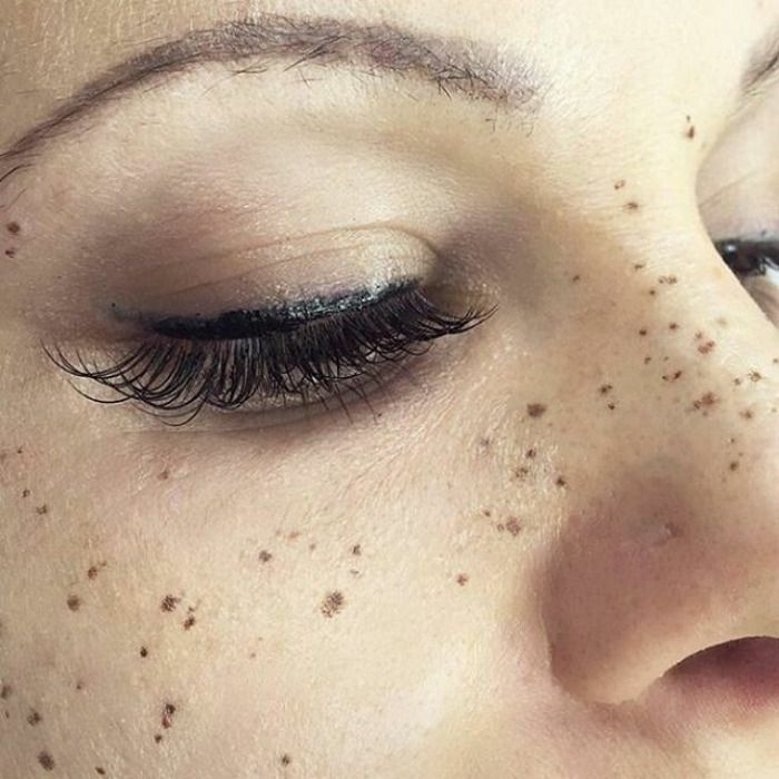Tattoo Freckles: Procedure, Aftercare, and Longevity