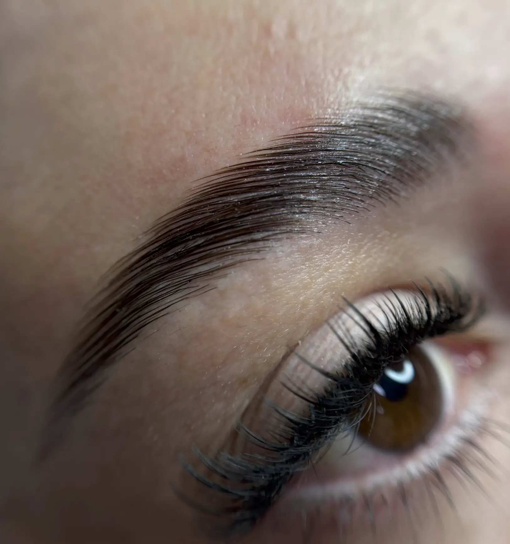 brow droop after botox