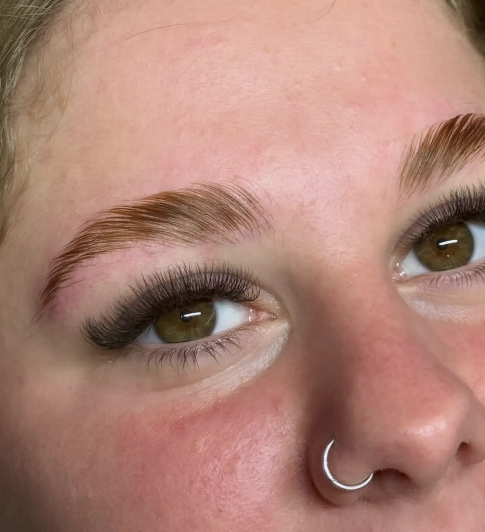 brow lift botox near me