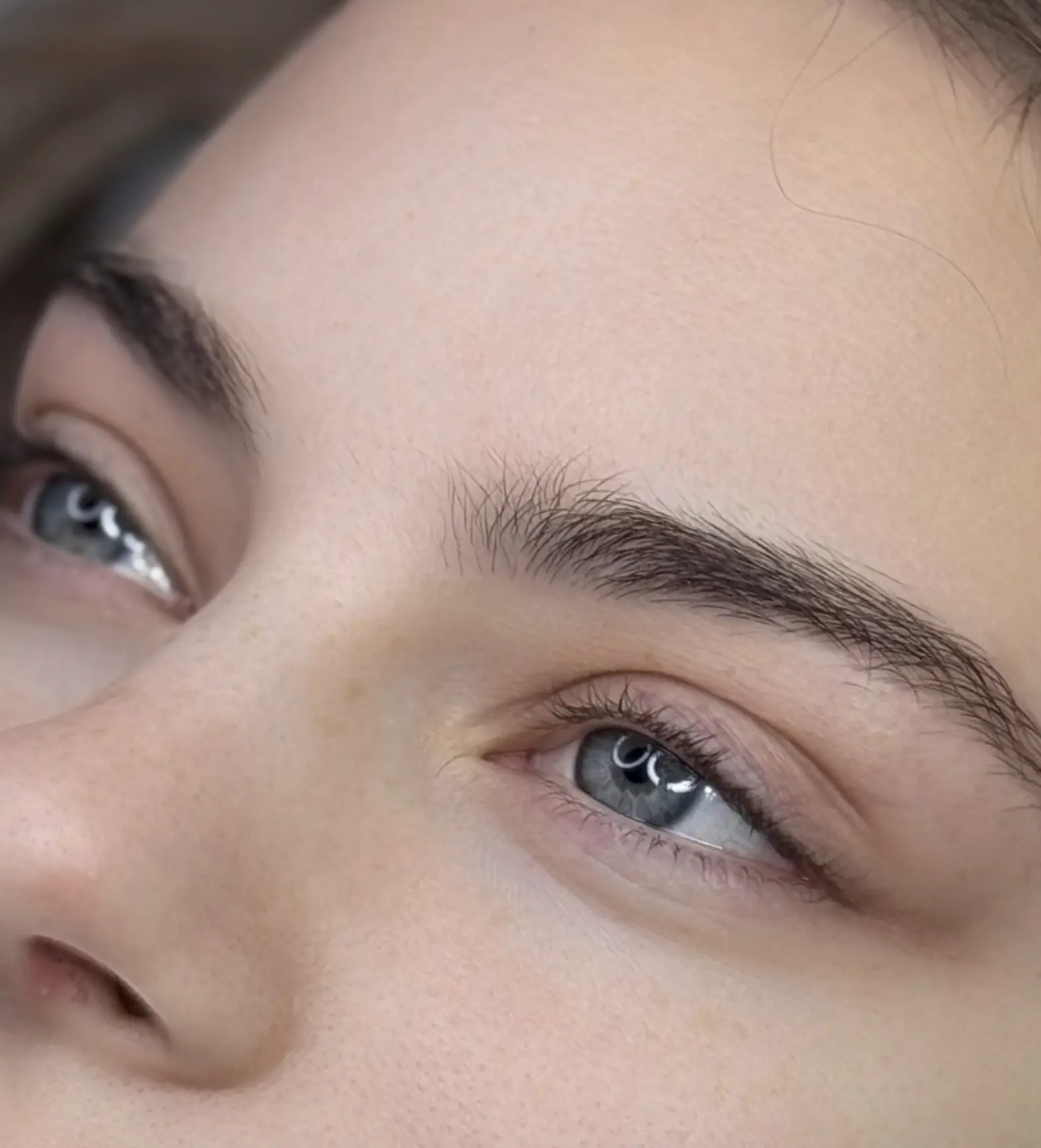 can botox lift eyebrows