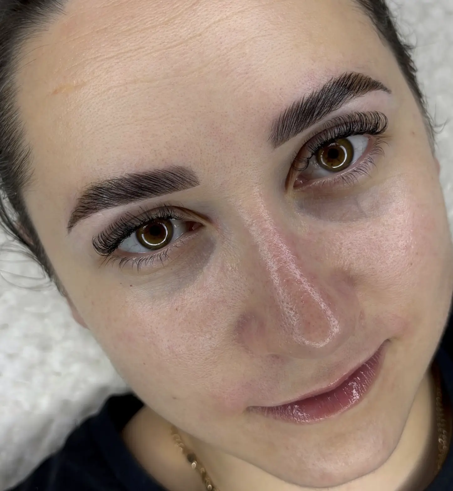 heavy brow botox