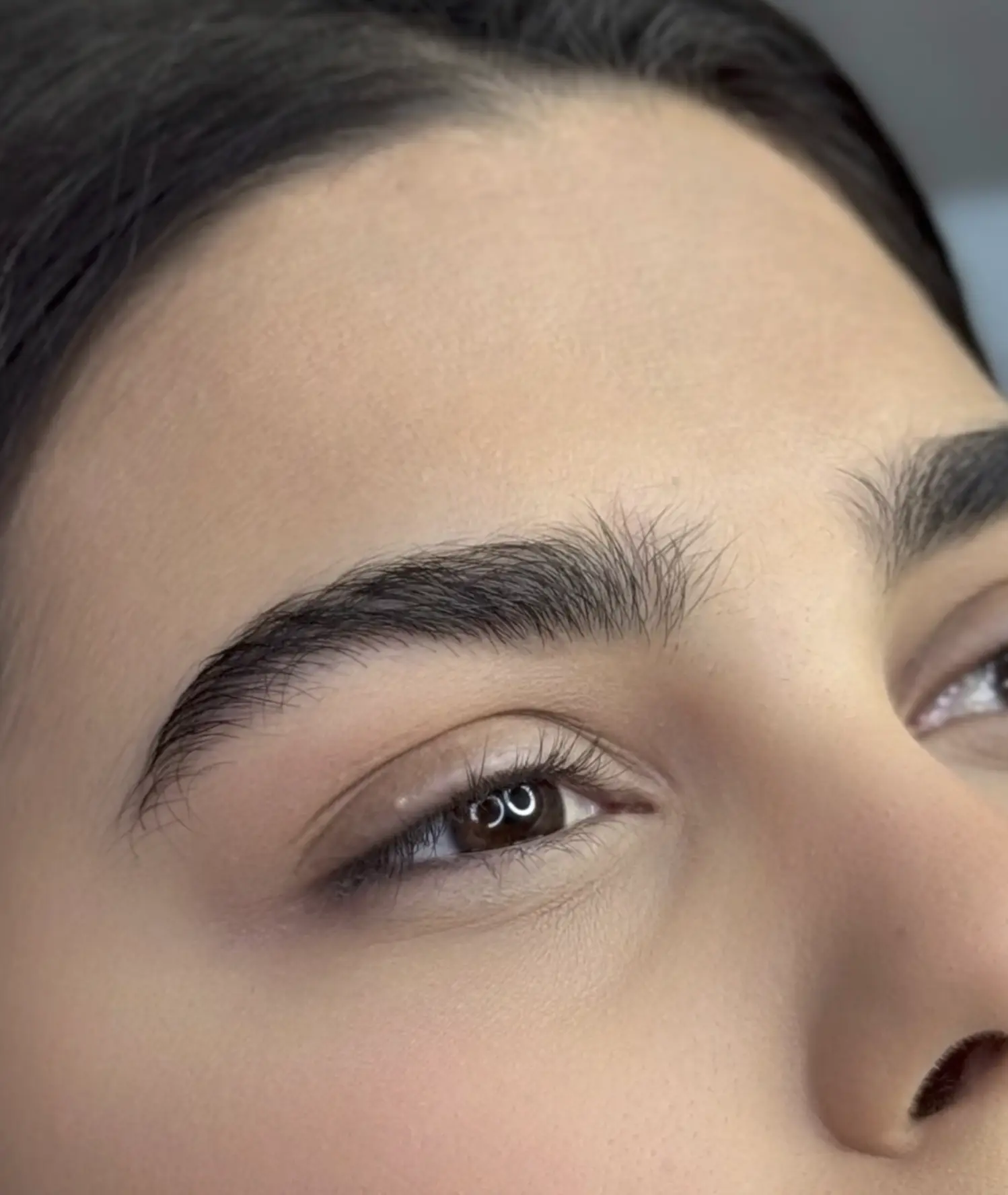 spock brow botox