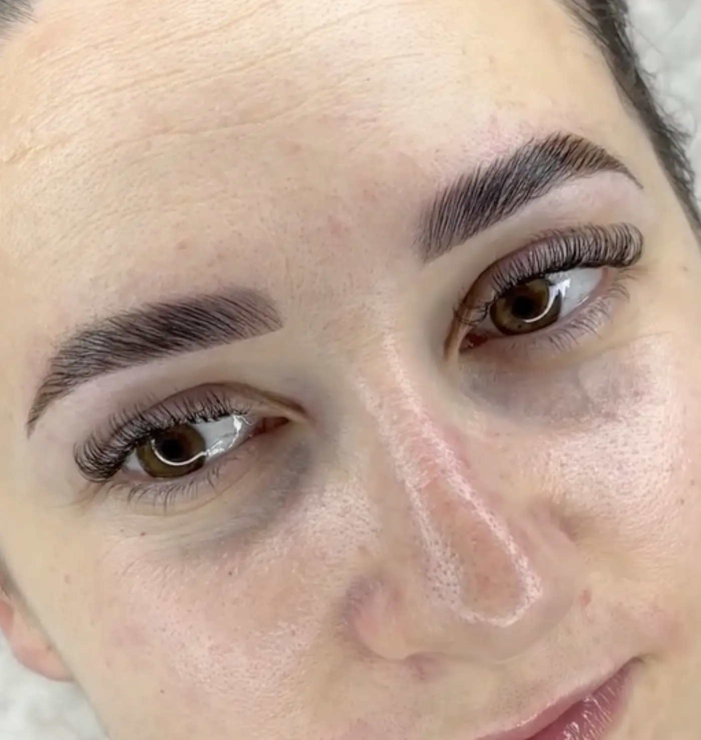 what is brow botox