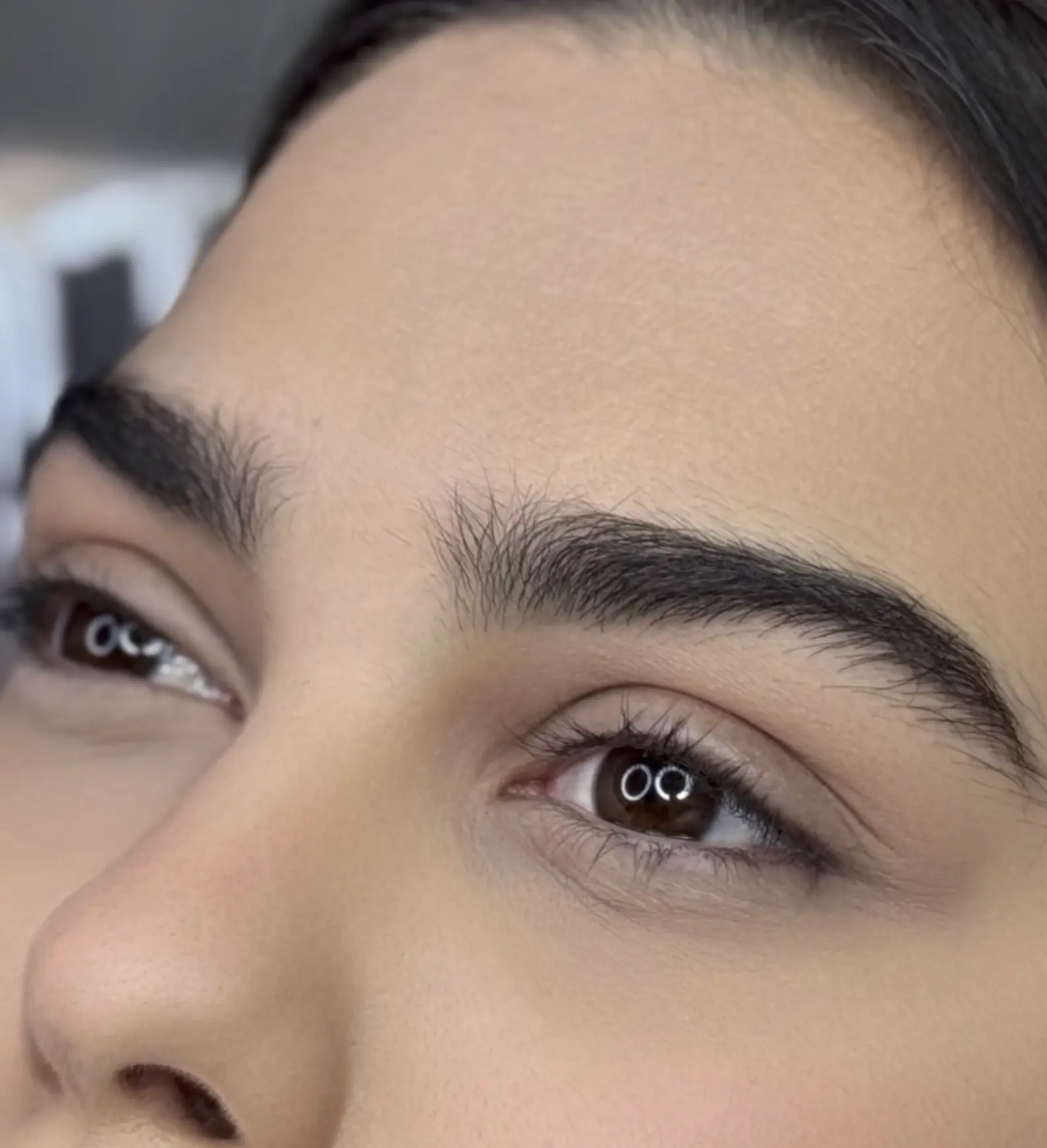 when does botox start to work